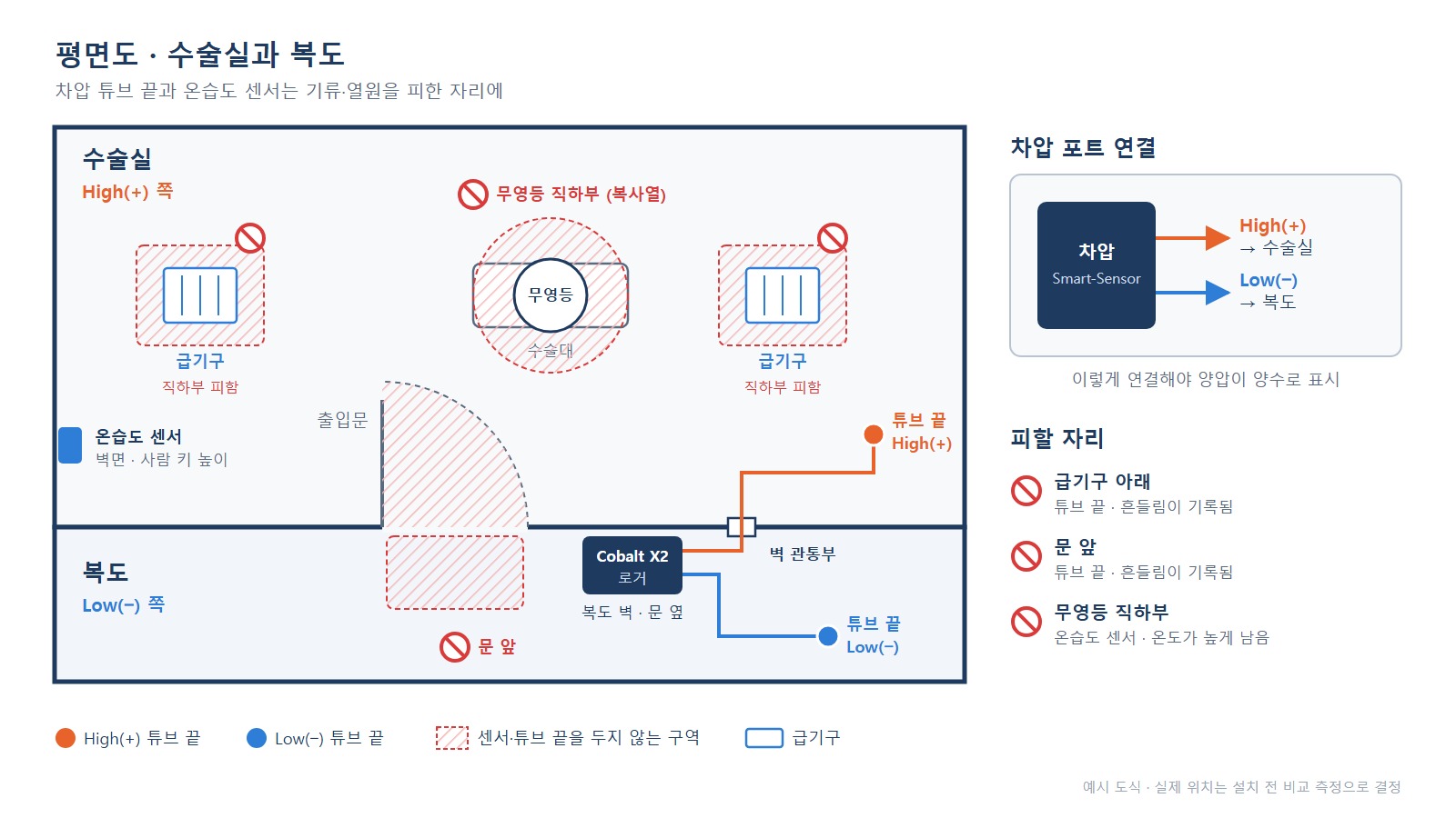 차압 튜브 배치 - 수술실과 복도 평면도, High(+) 포트와 기류 피한 튜브 끝